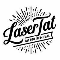 LaserTat