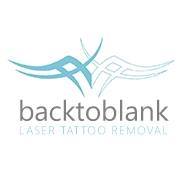 Back to Blank Laser Tattoo Removal