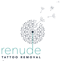 Renudelaser tattoo removal